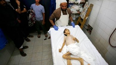 Israel Starves to Death