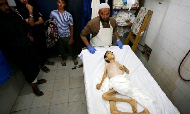 Israel Starves to Death