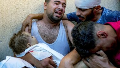 320 Cases of Severe Burns in 48 Hours in Gaza